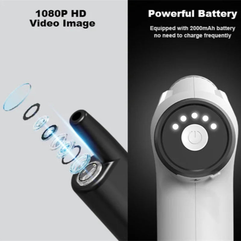 Kit Elétrico Limpeza Ouvidos Spray Suave - Seguro, Eficaz, 4 Pressões, 9 Pontas